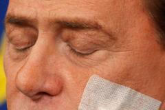 Silvio Berlusconi s náplastí po plastické operaci