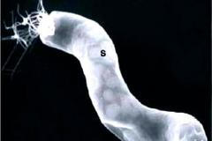 NASA zveřejnila další dávku snímků z hlubokého vesmíru