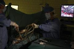 Laparoskopická operace jícnu