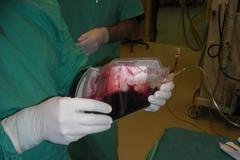 Buněčná suspenze připravená ve vaku