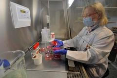 Baktérie E.coli na eppendorfské klinice