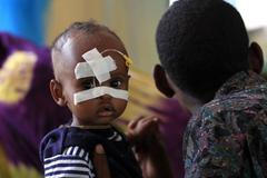 Hladomor v Somálsku