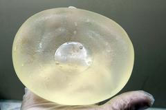 Lékaři vyjímají defektní silikonové prsní implantáty společnosti PIP