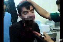 Zraněných chlapec z Homsu