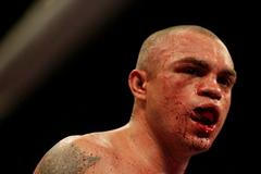 Hrozivá zranění v boxerské historii (Rodrigo Barrios)