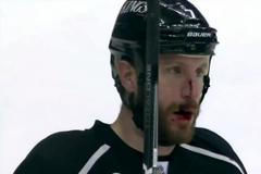 Zraněný Rob Scuderi z Los Angeles Kings po souboji se Stevem Bernierem
