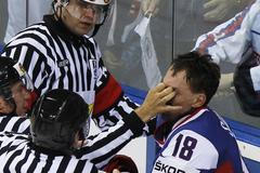 Šatan, Slovensko, hvězdy MS