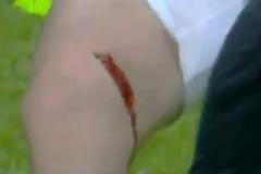 Hugo Rodallega z Fulhamu zranil po střele kolíky kopačky útočníka ManU Wayna Rooneyho