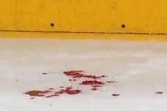 VIDEO V sérii Montrealu s Ottawou jde o zuby