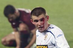 Fotbalista Brna Milan Lutonský se zranil v utkání proti Spartě během 14. kola Gambrinus ligy 2012/13.