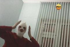 Šéf moskevského baletu po útoku kyselinou