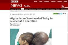 Dvouhlavá afghánská holčička