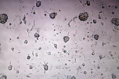 Referenční laboratoř pro chřipku