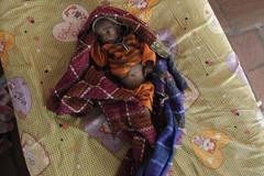 Podvyživené děti v Indii