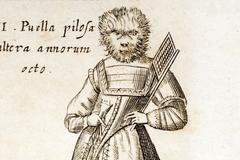 Fotogalerie: Hypertrichóza