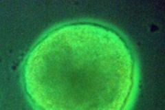 Kmenová buňka skrývá velký potenciál při léčbě úrazů.