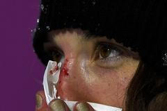 Soči 2014, U-rampa, lyže Ž: zraněná Angeli Vanlaanenová, USA