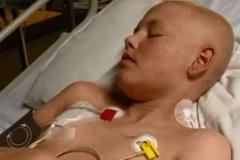 Hoch porazil leukémii