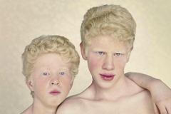 Fotografie albínů od Gustavo Lacerdy