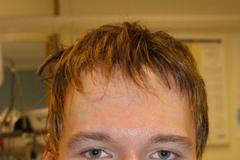 Neznámý muž se ztrátou paměti z Norska