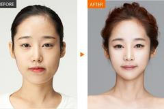 Plastické operace v Jižní Korey