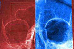 praxe soudní antropoložky Hany Eliášové