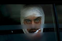 A wounded Ukrainian soldier looks through a windows as he arrives to a hospital in Artemivsk