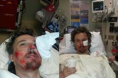 Pády, zlomeniny, tajemný virus. To byla kariéra smolaře Banka