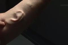 VIDEO Vědec si pěstuje ucho na ruce