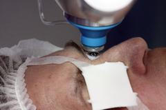 Očařka: Laserovým operacím oka věřím, riziko je ale vždycky