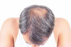 Hrstková: Léčitelé musí být trestně odpovědní. A urychleně