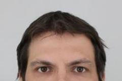 Pacient uprchlý z Bohnic