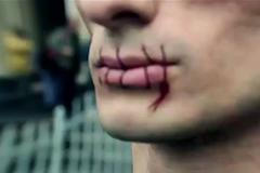 Ruský umělec bojuje s Kremlem pomocí nahoty a sebepoškozování