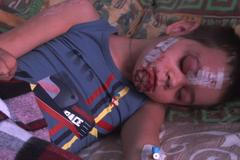 Dětská hra se na východní Ukrajině umí v okamžiku obrátit v neštěstí