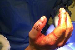 Pokousaná Lindsey Vonnová