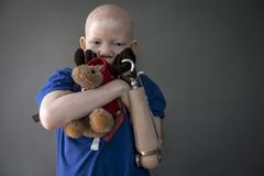 Albinismus v Tanzánii