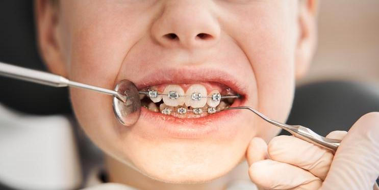 Lékařské zákroky u dětí