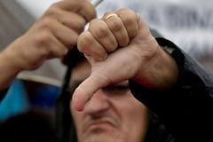 palec dolů ilustrační foto