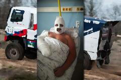 Zraněný Martin Kolomý.