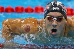 Michael Phelps of the US is seen with a red cupping mark on his shoulder as he competes in the Men's 4 x 100m Freestyle Relay Final at the 2016 Rio Olympics in Rio de Janeiro