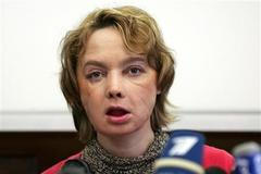 Žena s transplantovanou tváří