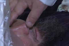 Léčitel tvrdí, že ničí rakovinu pomocí přípravků z rostlin. Operuje bez anestetik