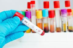 HIV test