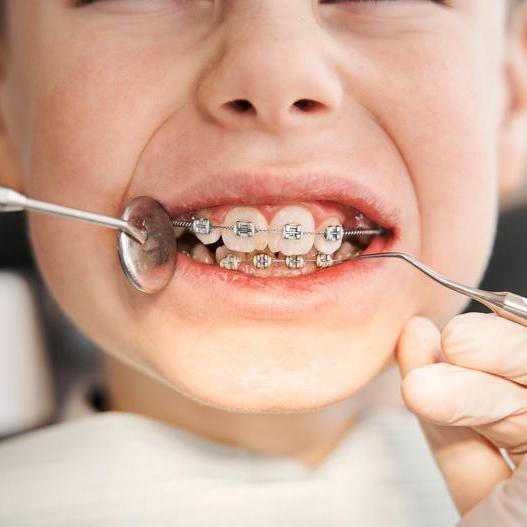 Lékařské zákroky u dětí