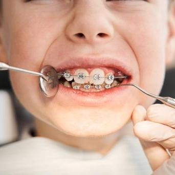 Lékařské zákroky u dětí