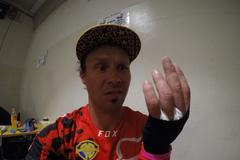 Libor Podmol s poraněnou dlaní