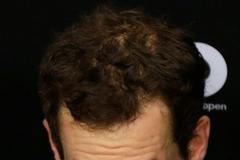 Australian Open 2017 (Andy Murray)