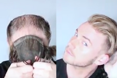 Husté vlasy bez transplantace. Salon nalepuje příčesky lepidlem