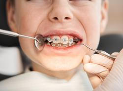 Lékařské zákroky u dětí