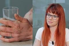 Osm kilo krémů za měsíc, péče šest hodin denně, čast jen bezmoc, to je ichtyóza, říká Žampachová